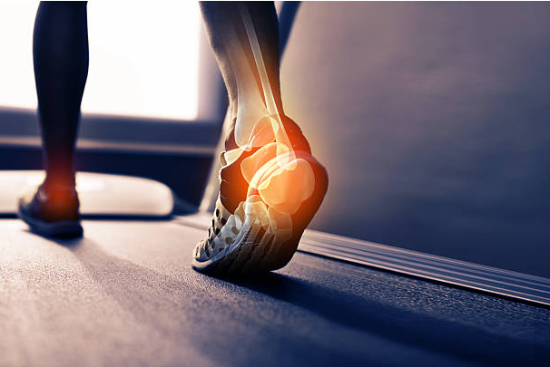 Heel and foot pain relief through chiropractic care at Ryan Chiropractic Wellness Georgetown and Taunton MA